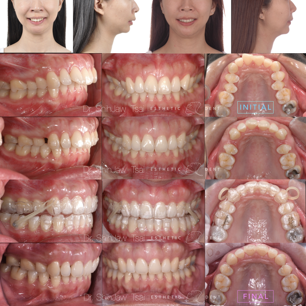 !Cases For Instagram_inv.005